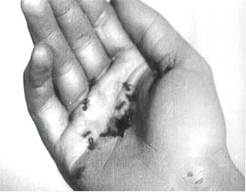 Las hormigas en la palma de la mano son idea de Dali. Simbolizan el deseo sexual.